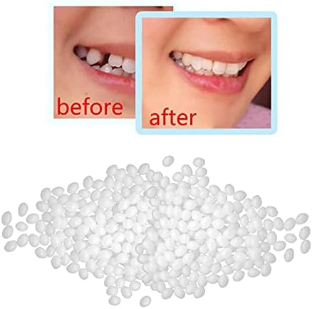 Geçici Diş Tamir Kiti Diş Restorasyon Kiti Diş Tamir Katı Jel Dişler ve İnterstisyel Protezler Katı Dişler ve İnterstisyel Protezler