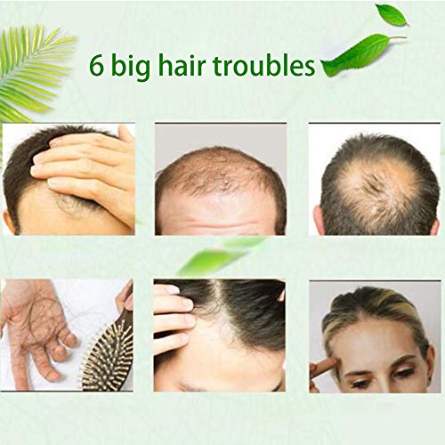 Zencefil Saç Büyüme Serumu,SUNSENT Zencefil Saç Büyüme Esansiyel Yağı, Kadınlar ve Erkekler İçin Saç Dökülmesi Tedavisi, Anti